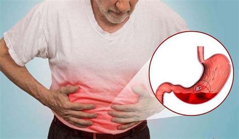 đau dạ dày thì nên làm gì